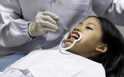Dentist applying fluoride in Birmingham