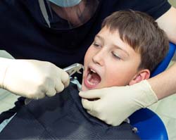 child having tooth extraction in Homewood